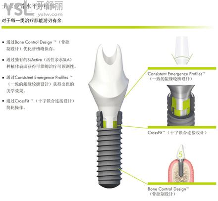 瑞士种植牙品牌及价格是多少告诉你瑞士种植体iti三种档次该如何选择