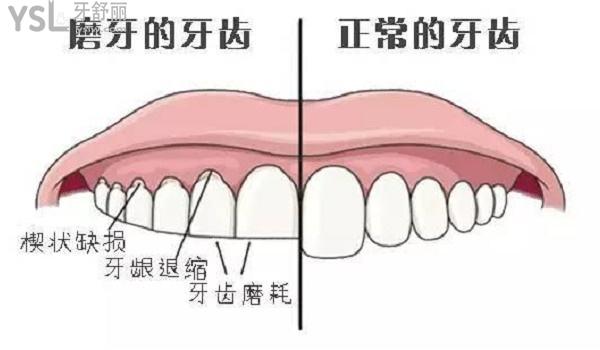 前磨牙是哪颗牙图片图片