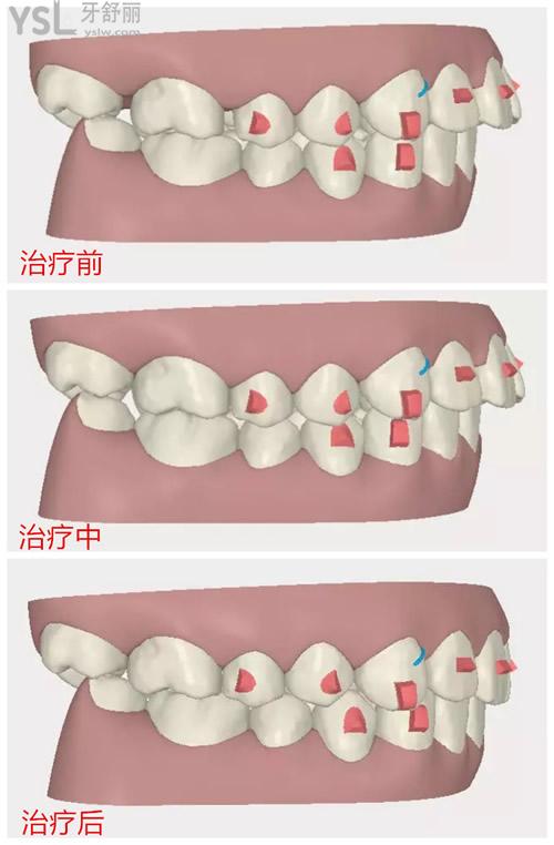 {3EF11F09-A411-4E6D-A33F-29E297DAF974}_20200309150553_副本.jpg