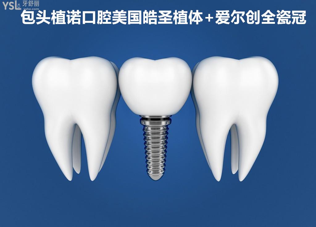 包头植诺口腔美国皓圣植体爱尔创全瓷冠价格怎么样