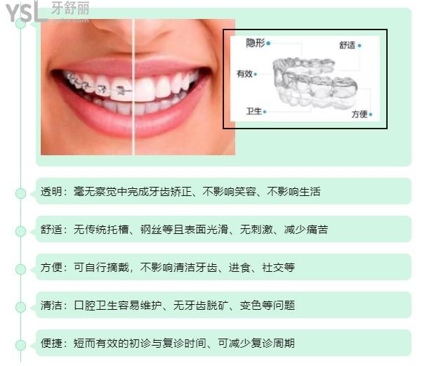无托槽隐形矫正主要适用于个别牙错位,牙列拥挤,牙齿不整齐,牙间抖