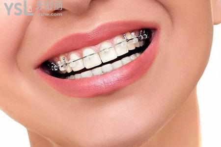 种植牙的使用寿命有多长与那些因素有关？