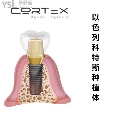 以色列科特斯（cortex种植体）