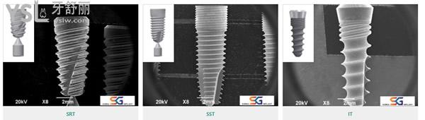 韩国sg种植体
