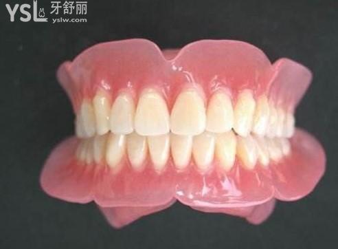 假牙种类图片