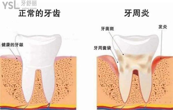 晓萌牙讲座009章，主攻60岁老人牙齿松动怎么办