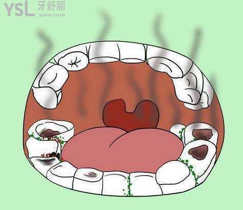 網友1381123提問牙周炎全口假牙三十歲牙周炎遇上年輕的自己怎麼辦