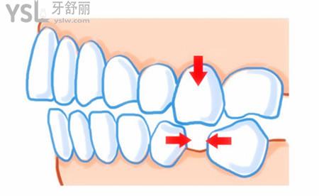 u=3295867573,1964107541&fm=26&gp=0 (1).jpg