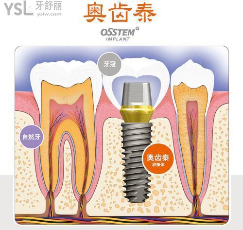 下载.jpg