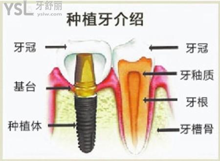 下载.jpg