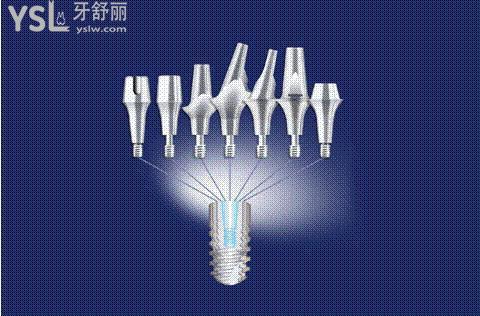 首先我們都知道種植牙其實主要分為種植體,基臺,牙冠三個部分.