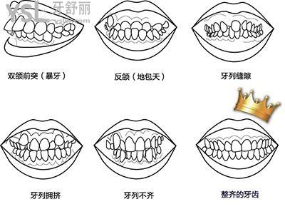 牙齿矫正