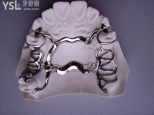 它主要是在接近缺牙的缝隙上设计rpi型卡环或rpa型卡环,在进行咬合的