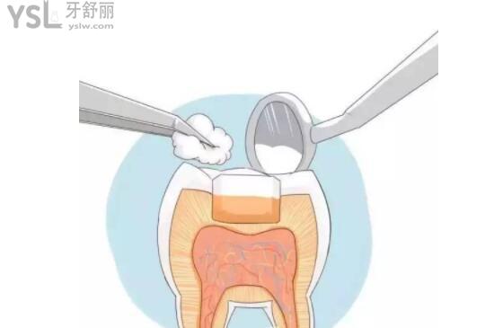 补牙卡通配图