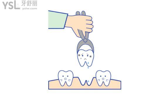 拔牙卡通配图