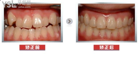 桂林牙博士口腔牙齿矫正<span style=