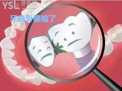 你的牙槽骨萎缩了吗？