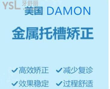 damonq自锁托槽价位