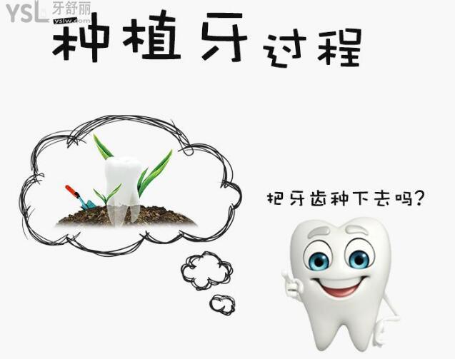 zimmer种植体价格高，它值那个价吗？.jpg