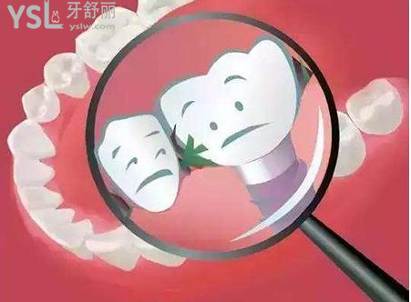 种植牙出血怎么处理