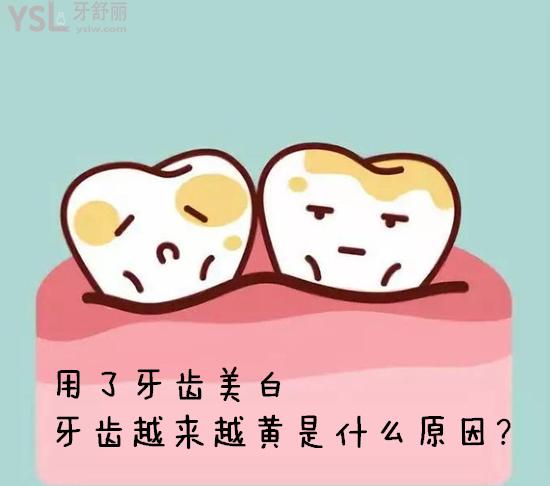 牙齿越来越黄是什么原因？