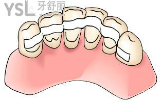 小孩牙齒受傷鬆動疼痛怎麼辦?