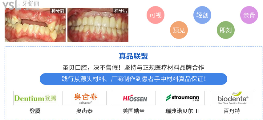 西安种植牙比较好的医院