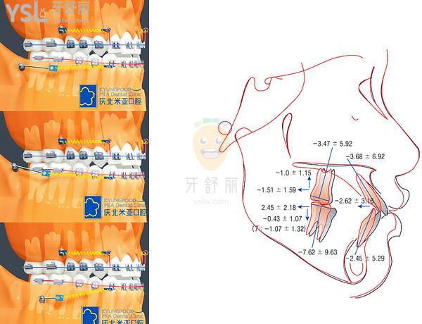 北京庆北米亚口腔矫正优势