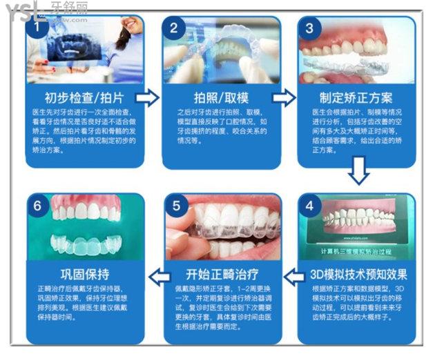 北京溪美康口腔矫正过程