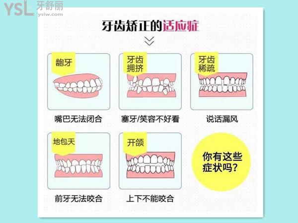 牙齿矫正的适应症