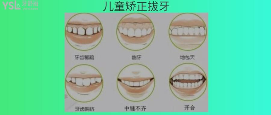 儿童正畸拔牙的危害