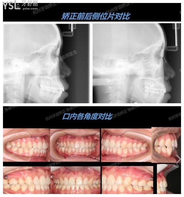 正畸