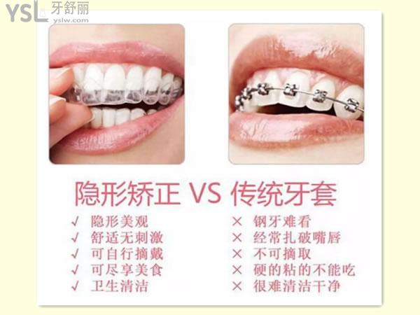 想知道隱形牙套適合什麼樣牙齒這幾種牙齒畸形矯正很適合點擊get