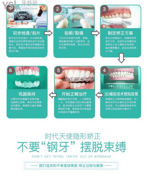 北京维恩口腔隐形矫正过程