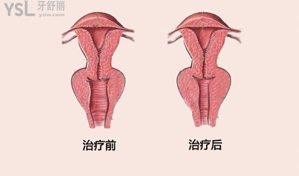 产道是指哪个部位图片