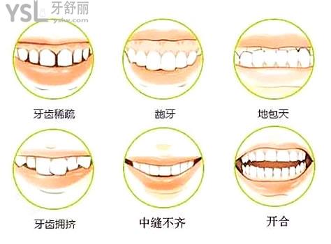 矫正器1_副本.jpg