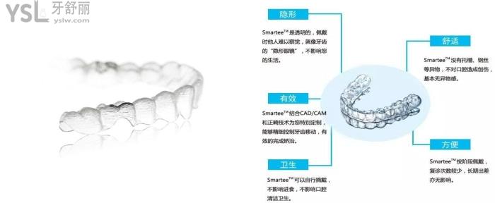 隐形牙套的优点.jpg