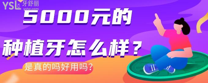 5000元的种植牙怎么样？是真的吗好用吗？.jpg