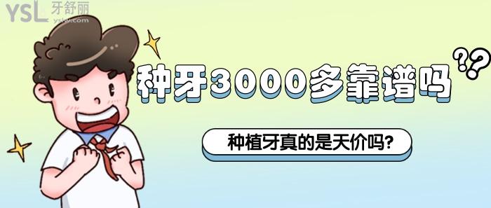 种牙3000多靠谱吗