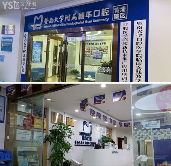 广州戴牙套箍牙较好的医院,这几家矫正技术好价格公开透明