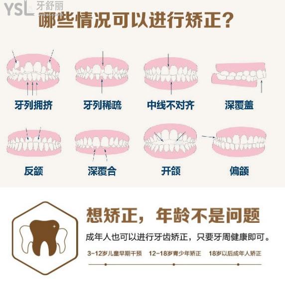 哪些情况可以进行牙齿矫正