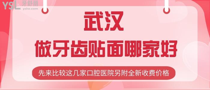 武汉做牙齿贴面哪家好？先来比较这几家口腔医院另附全新收费价格