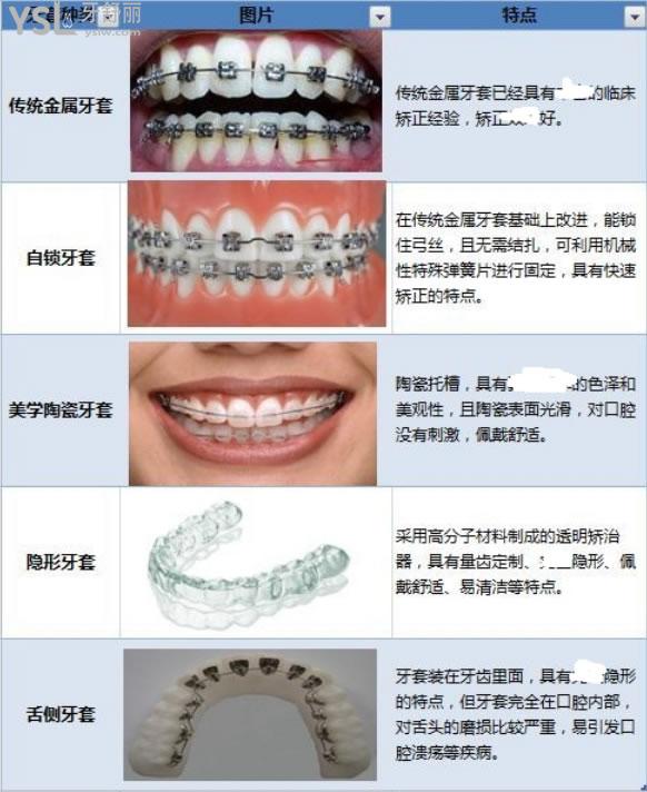 格伦菲尔口腔收费价格表