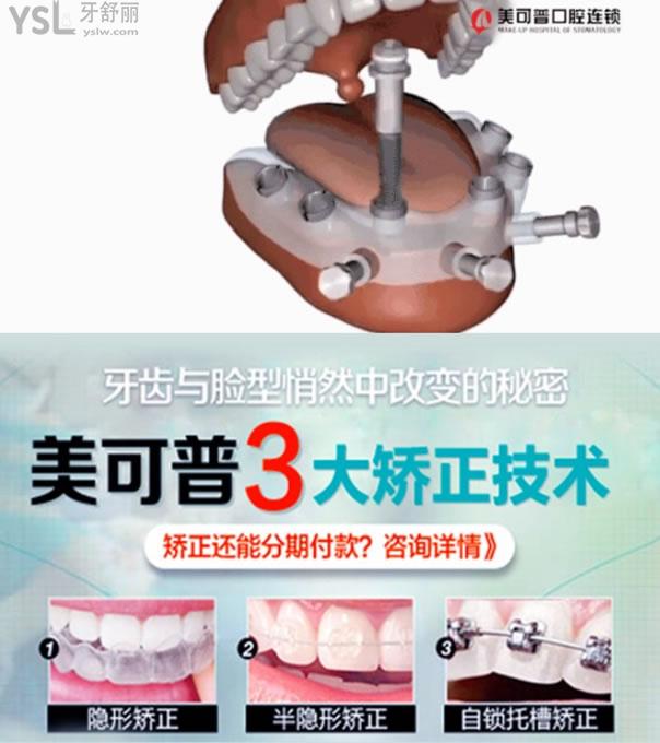 福州美可普口腔医院牙齿矫正和种植牙技术优势