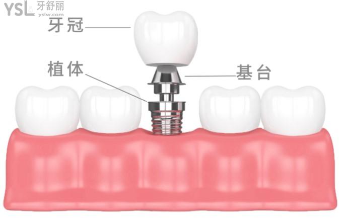 重庆美奥口腔6月活动