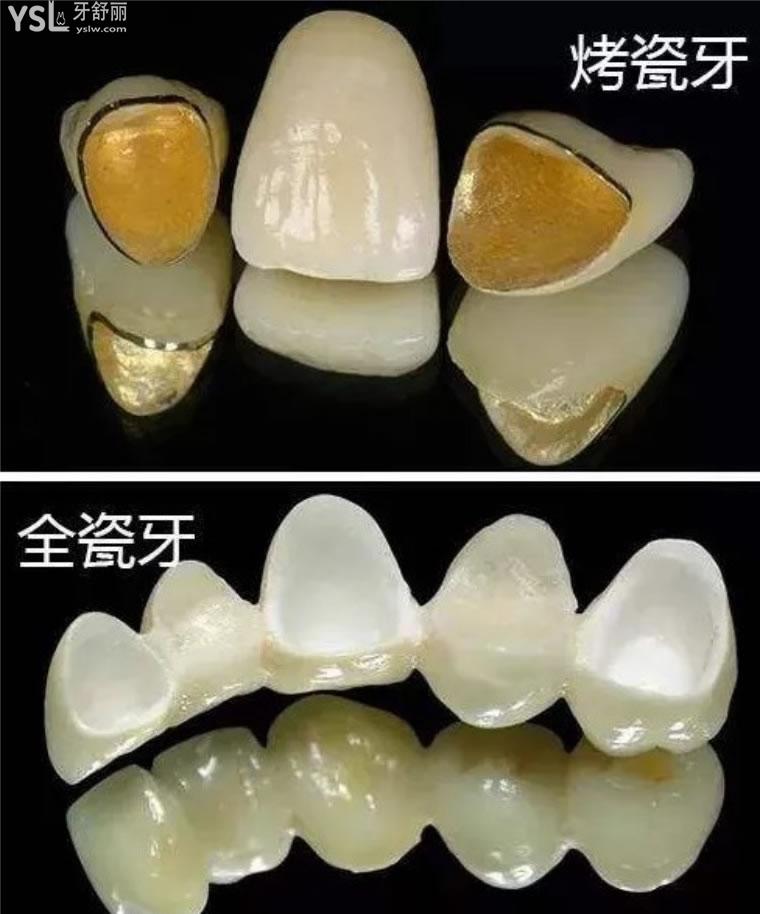 合肥全瓷牙冠价格隆重推出包含合肥各个正规口腔医院的全瓷牙冠价格表