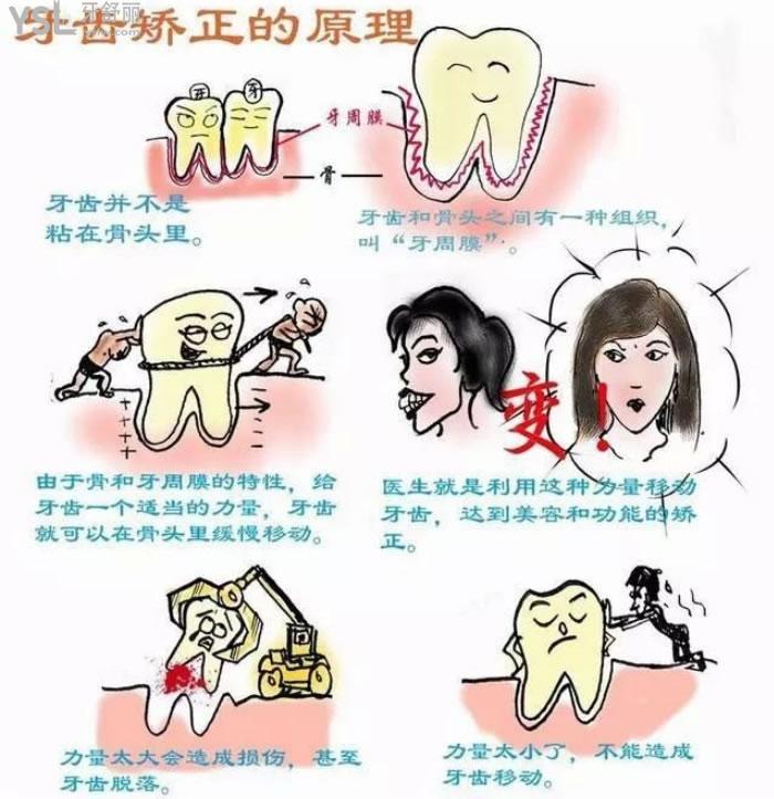 西安隐形牙套费用大概多少