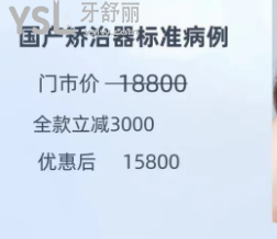 百适美口腔医院隐适美全款立减7000，我要冲了！