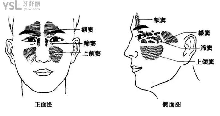 上颌窦图片位置图片