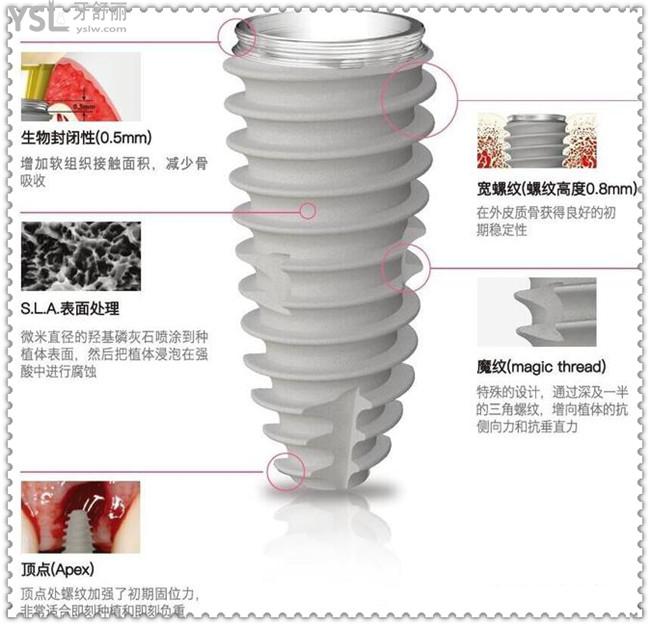 韩国neo（纽百特）种植体